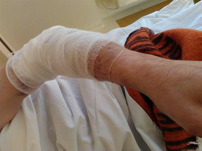 Mărturia omului sfâşiat de câini. „Renunţasem. Eram convins că voi muri”. ATENŢIE: imagini şocante!