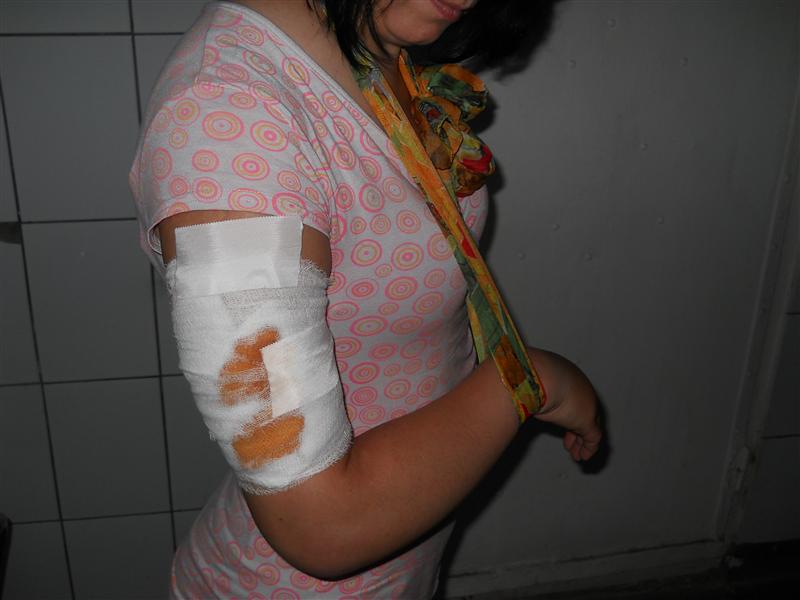 Angajată la Compania de Apă Someş, atacată şi sfâşiată în plină stradă de un ciobănesc caucazian 