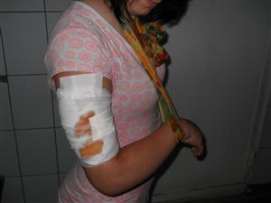 Angajată la Compania de Apă Someş, atacată şi sfâşiată în plină stradă de un ciobănesc caucazian 