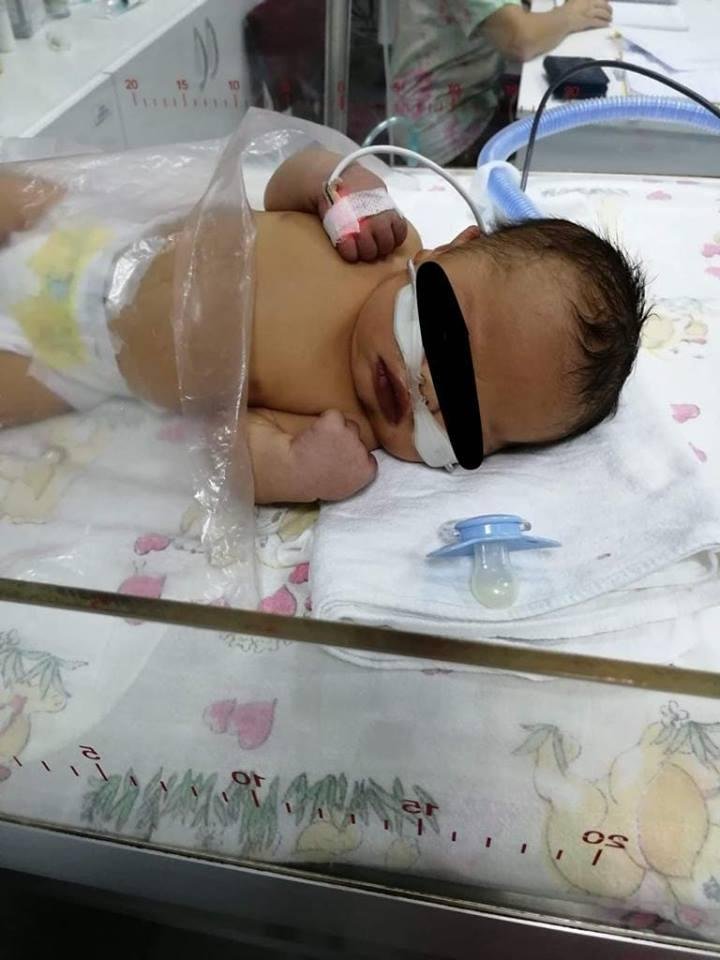 Încă un copil cu malformație gravă a inimii, operat la Cluj. Ungureanu: " De ce nu sunt depistate în timpul sarcinii?"