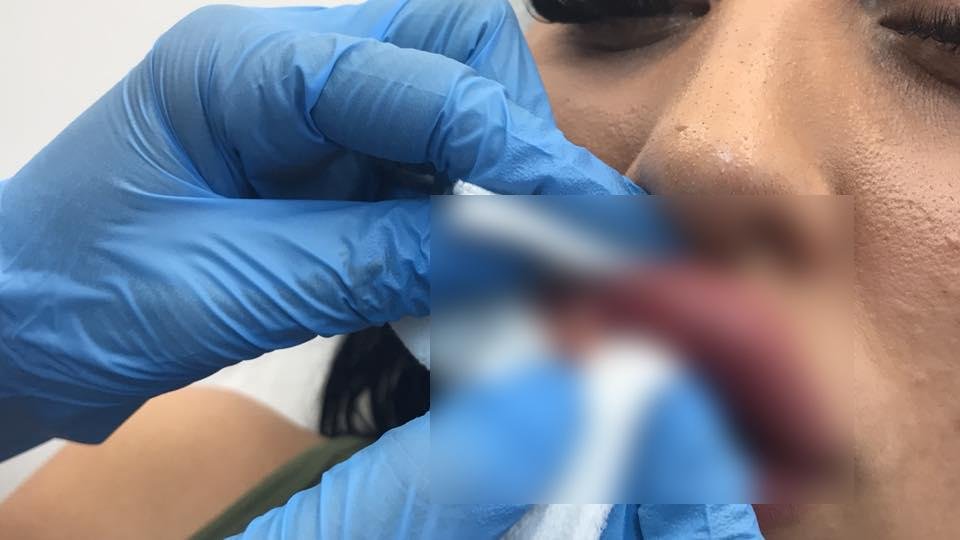 Coronavirus: Informare de interes public pentru clujeni
