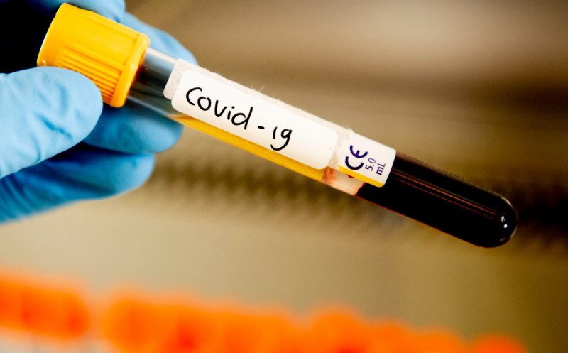 Coronavirus România: 4.761 cazuri, 220 decese, 528 vindecaţi, 162 persoane la terapie intensivă