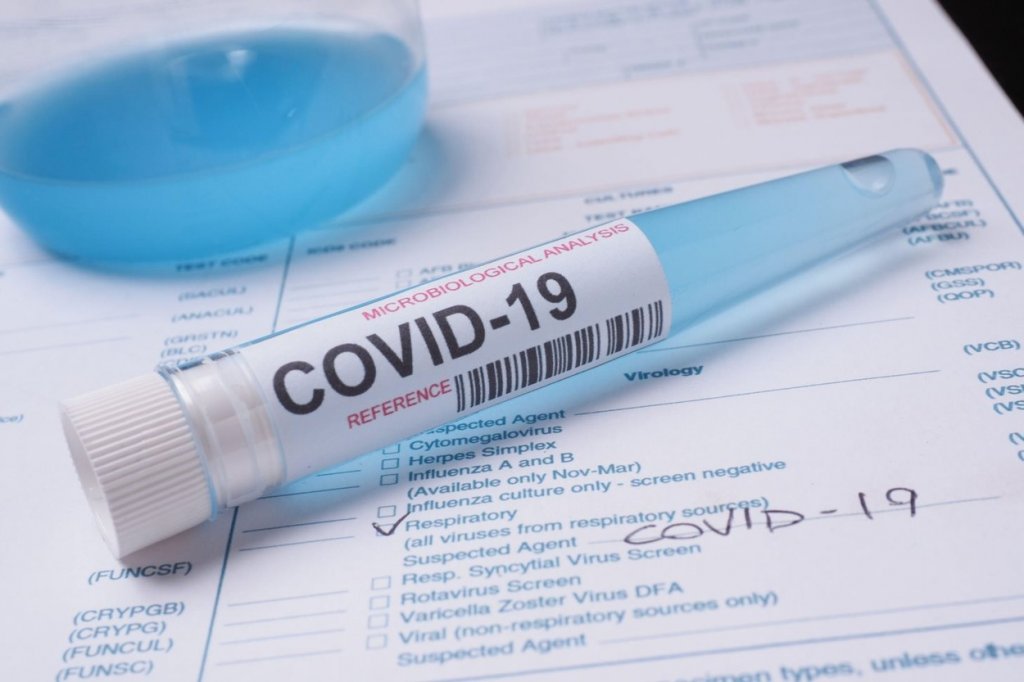 Coronavirus: Sângele pacienţilor infectaţi folosit în dezvoltarea unui tratament
