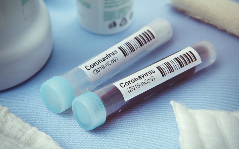 Moldovan, Ministerul Sănătăţii: Testele PCR, siguranţă de 98%/ numărul mare de testări poate să pună probleme de gestiune a probelor