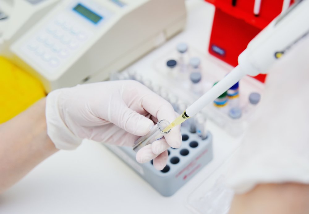 Studiu: O proteină ar putea juca un rol important în cazul pacienţilor cu forme severe de COVID-19