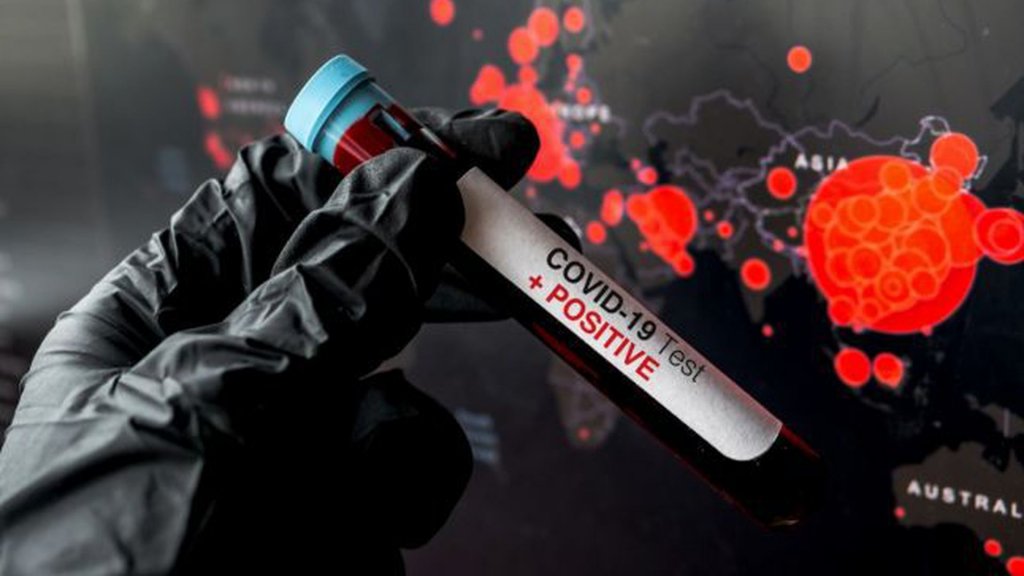 România se îndreaptă spre 87.000 de cazuri de COVID-19, cu 952 de cazuri noi în ultimele 24 de ore