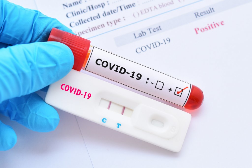 Alertă INSP: Trend ascendent al infecțiilor în aproape toate județele/ Sute de focare COVID
