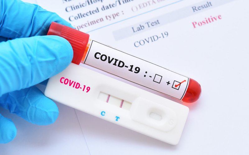 Alertă INSP: Trend ascendent al infecțiilor în aproape toate județele/ Sute de focare COVID