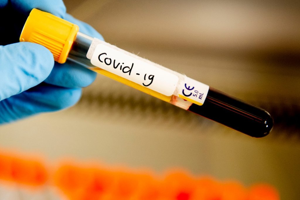 Pentru cine decontează Guvernul testele COVID-19?