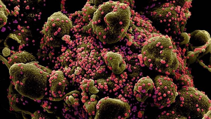 Tulpina braziliană de COVID-19 poate reinfecta peste 60% dintre cei care au trecut prin boală