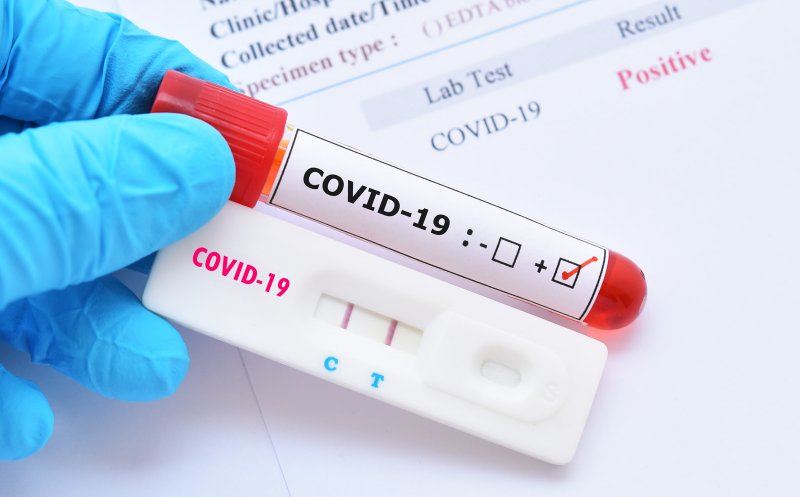 În ce farmacii se vor putea face teste COVID-19