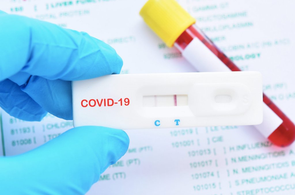 5 persoane infectate cu COVID-19 la Cluj și două decese în ultimele 24 de ore