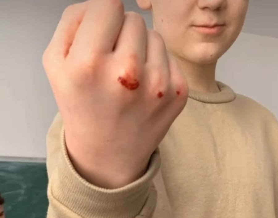 Pericol în școlile din Cluj. „Moneda rusească”, jocul violent practicat de elevi în pauze
