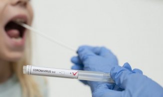 Prezenţa unor proteine în salivă ar putea indica o formă gravă de COVID