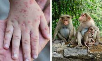 UE vrea să cumpere vaccinuri împotriva variolei maimuței. Când ar putea ajunge și la noi