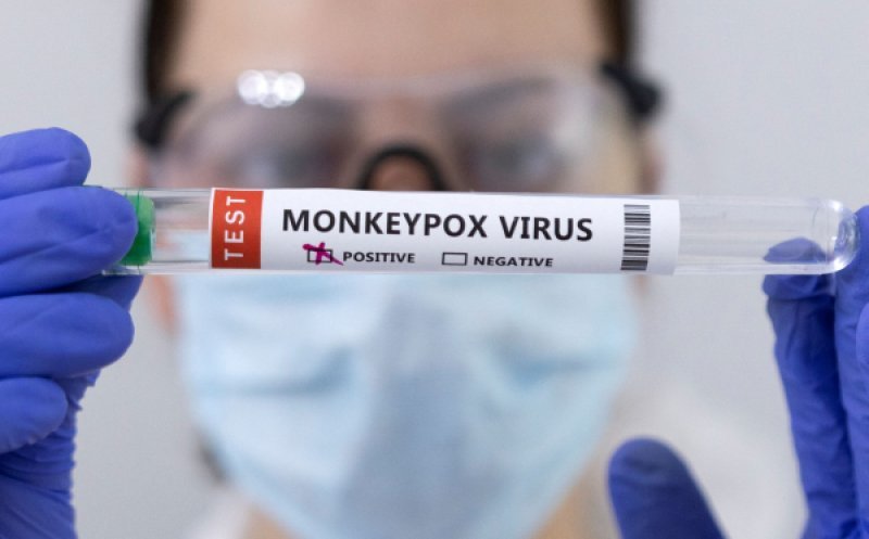 Al patrulea caz cu variola maimuței în România. Persoana infectată, contact cu primul caz