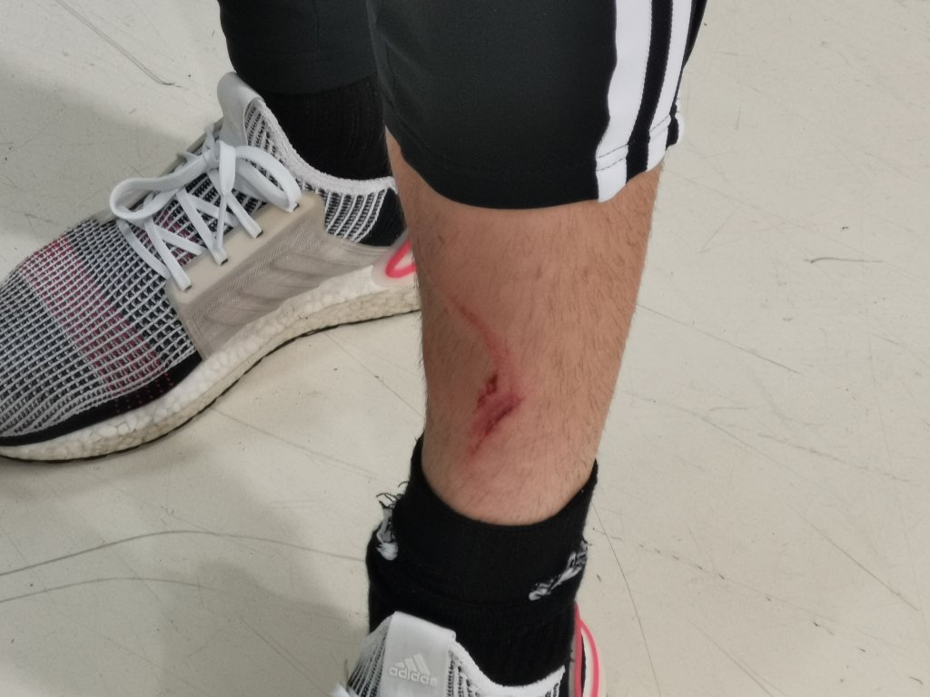Cum arată piciorul lui Fulop după intrarea lui Yeboah: "Ce să-i mai spun arbitrului, dacă mă ia cu ’mă, ce vrei, mă’?"
