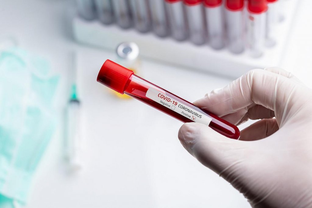 Peste 3.000 de subvariante BA.5 ale Omicron confirmate în România