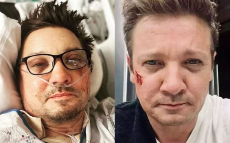 Ce a pățit, de fapt, Jeremy Renner în timp ce curăța zăpada: "Am peste 30 de oase rupte"