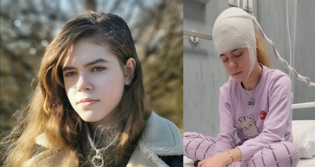 Ajutați-o pe Daria să se facă bine! Adolescenta face până la 50 de crize de epilepsie pe zi