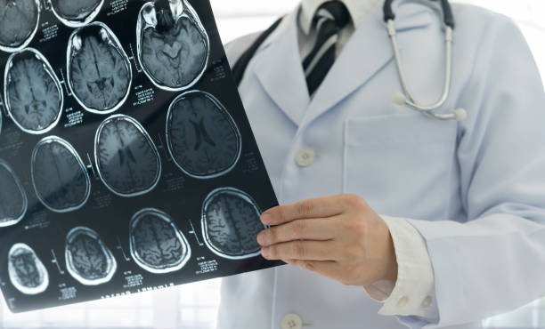 Rafila: Bolile cardiovasculare şi cerebrovasculare, principala cauză de boală, morbiditate şi mortalitate în România