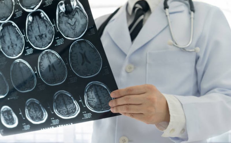 Rafila: Bolile cardiovasculare şi cerebrovasculare, principala cauză de boală, morbiditate şi mortalitate în România