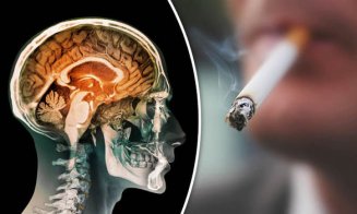 Fumatul zilnic micșorează creierul, potrivit unui nou studiu