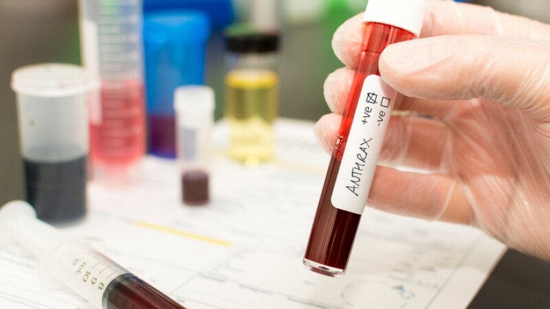 Alertă de ANTRAX! Trei bărbați, internați cu suspiciune de infecție. Unul a fost operat de urgență