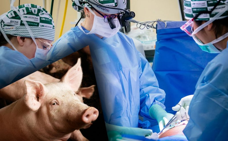 Record în lumea medicală: Rinichi de PORC transplantat la OM, încă funcțional la o lună de la operație