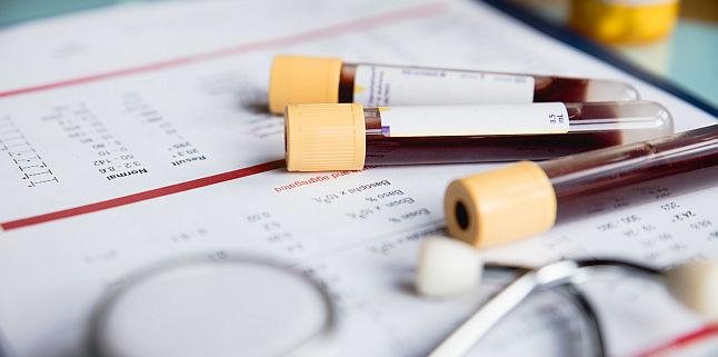 Intoxicaţia cu plumb, fenomen drastic subestimat pentru sănătatea publică. Printre consecințe, milioane de decese și afectarea cognitivă a copiilor