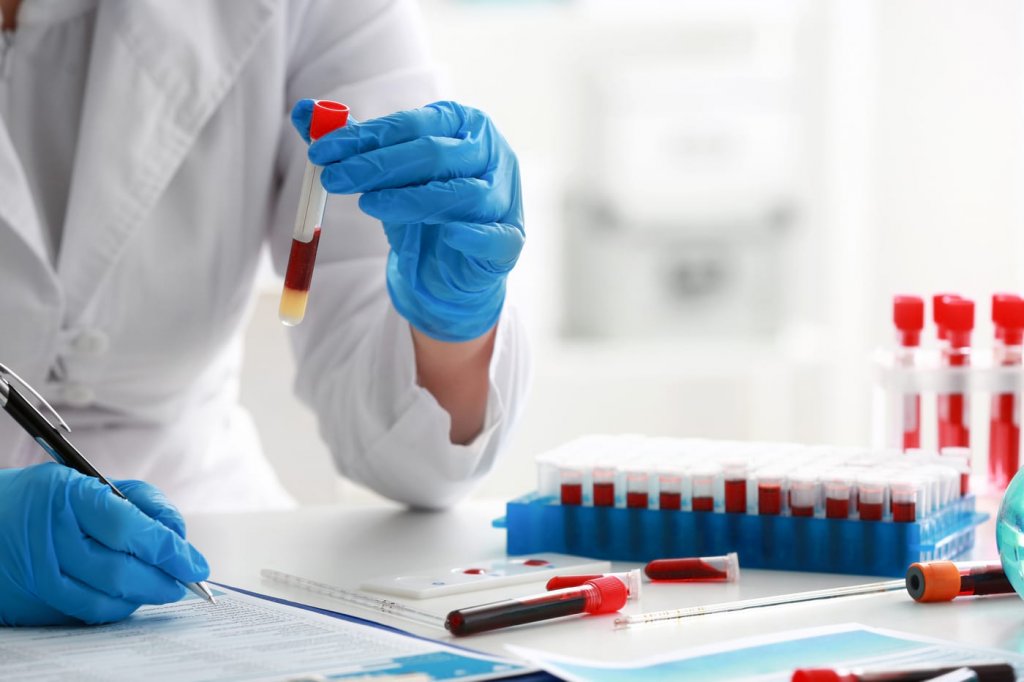 Avertismentul unui medic: Un factor aparent banal pentru apariţia cancerelor hematologice este fumatul