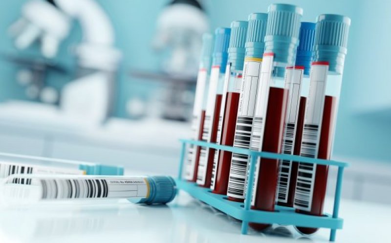 Un nou test de sânge poate prezice riscul de reapariţie a unui tip de cancer cu ani înainte ca tumorile să fie detectabile
