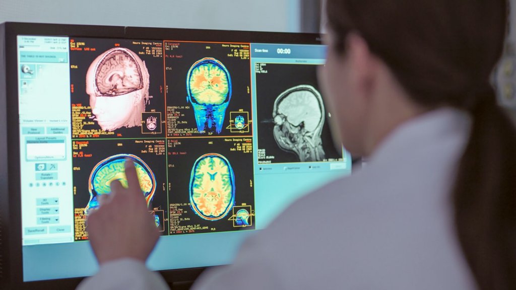 Oamenii de știință au identificat o nouă afecțiune, care imită Alzheimerul
