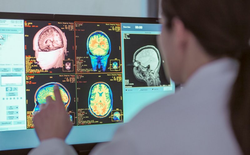 Oamenii de știință au identificat o nouă afecțiune, care imită Alzheimerul