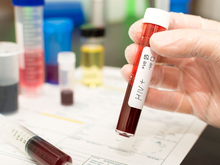 Sute de cazuri noi de HIV/SIDA, depistate în primul semestru al acestui an. Care au fost principalele căi de transmitere