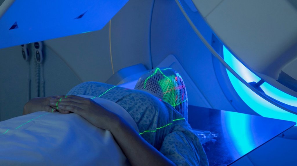 De ce mor diferit celulele canceroase după tratamentul cu radiaţii?