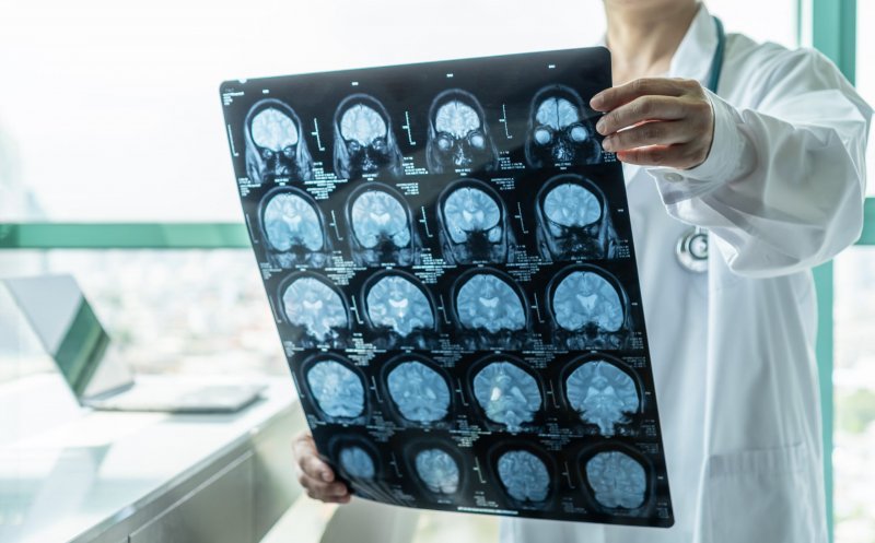 Studiu: Anumite vaccinuri ar putea reduce riscul de Alzheimer