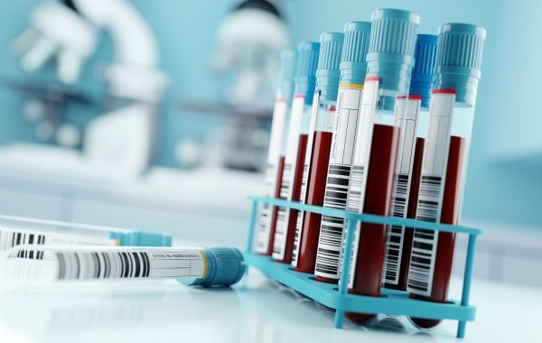 Un nou test de sânge poate detecta 12 tipuri de cancer înainte de apariția simptomelor