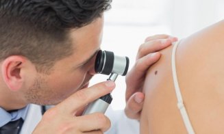 Zonele corpului pe care femeile și bărbații dezvoltă cancer de piele diferă. Care sunt acestea