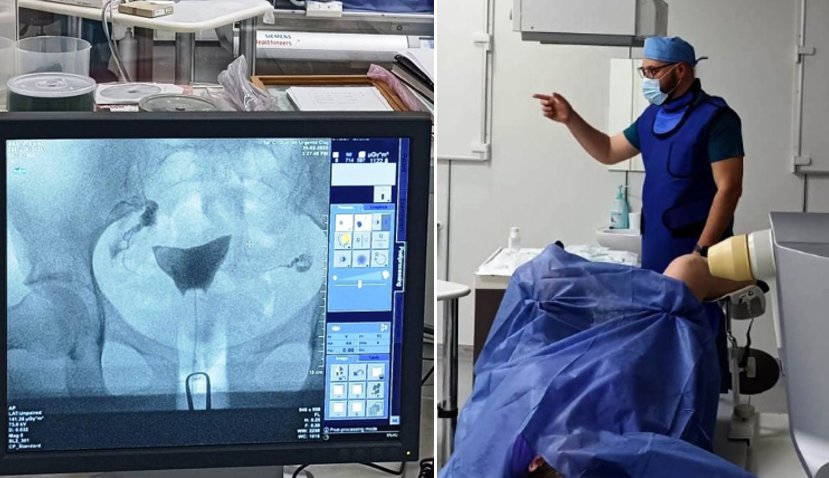 Procedură medicală în premieră, la SCJU Cluj, pentru diagnosticarea infertilității sau a altor afecțiuni ale uterului și trompelor uterine