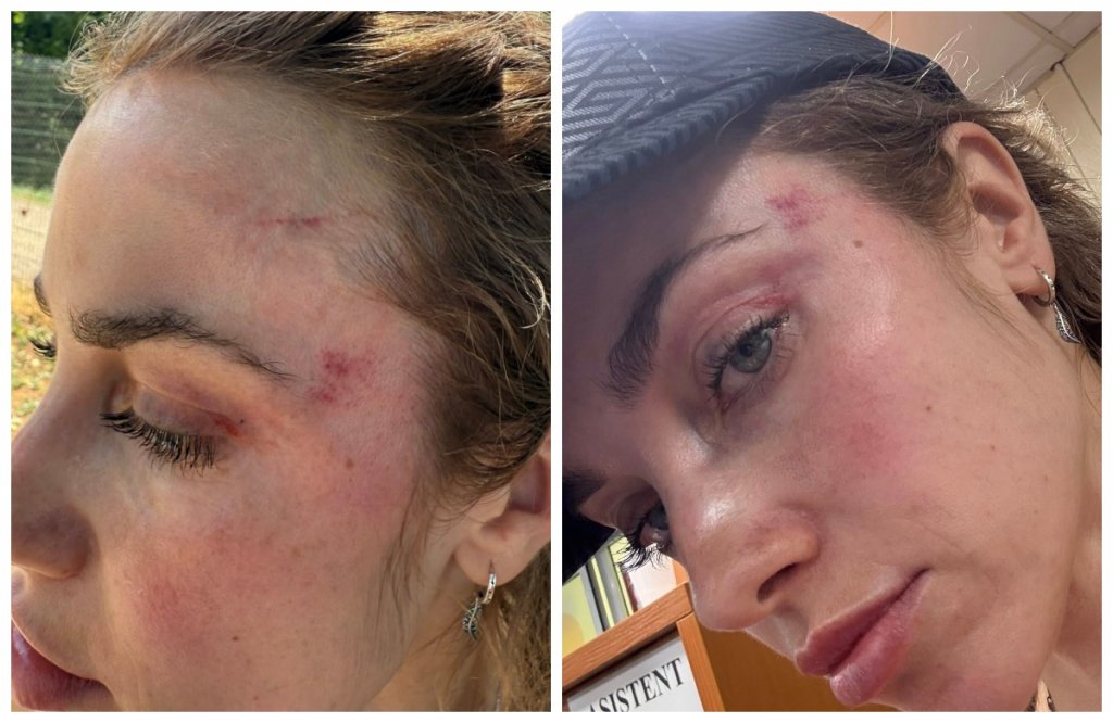 Scandal în Parcul Rozelor din Cluj: O mămică susține că a fost agresată de un bărbat, chiar în fața fiicei sale: "A început să mă lovească"