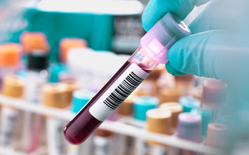 Un test de sânge ar putea detecta cu precizie un tip de cancer în stadii incipiente