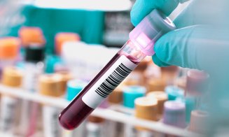 Un test de sânge ar putea detecta cu precizie un tip de cancer în stadii incipiente