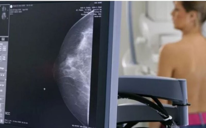 Rogobete promite o strategie națională de screening și prevenție: "În România nu se face screening așa cum ar putea țara asta să facă"