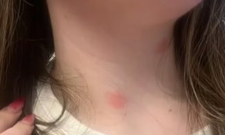 Ciuruită de ploșnițe la cușeta CFR Călători pe ruta București - Sighet / 13 ore în ”trenul groazei ”, la 190 de lei