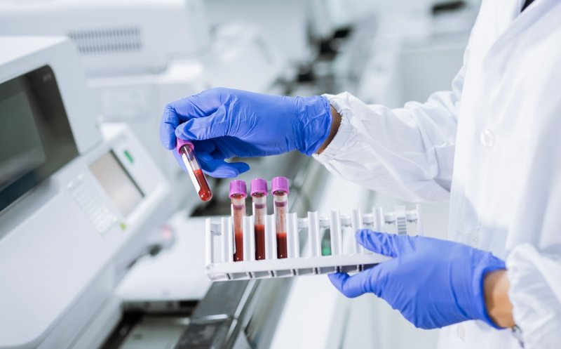 Tot ce se știe despre cele două surori confirmate cu lepră. Pe unde umblau și ce simptome au avut/ Ce arată raportul actualizat al anchetei epidemiologice