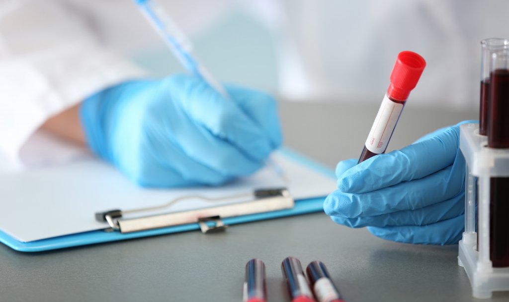 Noi reguli pentru pacienți în România! Cine nu mai are prioritate la analize medicale