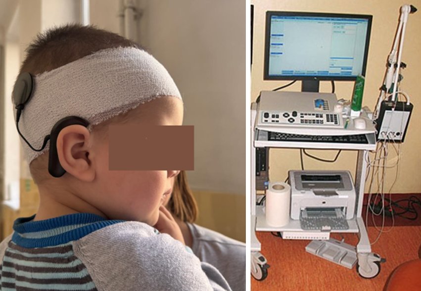 Aparatură de ultimă generație la SCJU Cluj pentru depistarea pierderii de auz încă din primele zile de viață