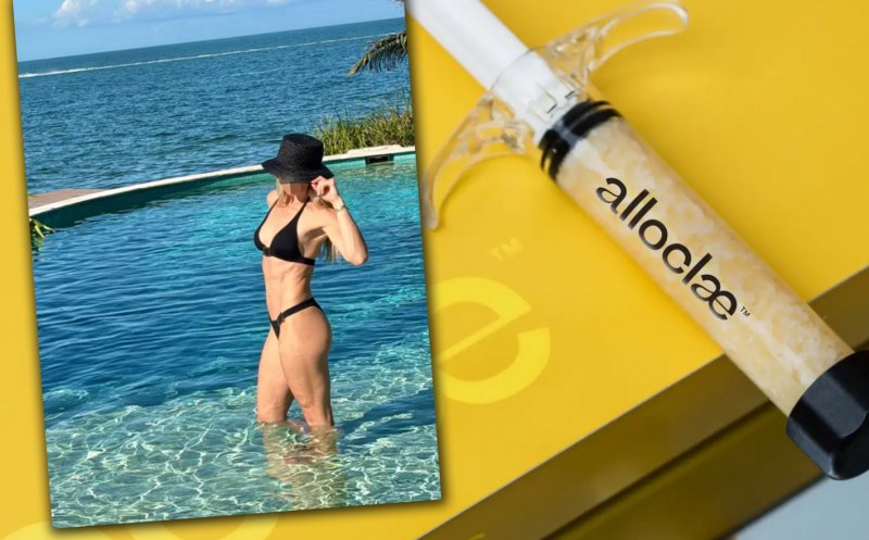 Procedură MACABRĂ pentru corpul perfect: Grăsime injectată de la donatori decedați / „Reciclăm”