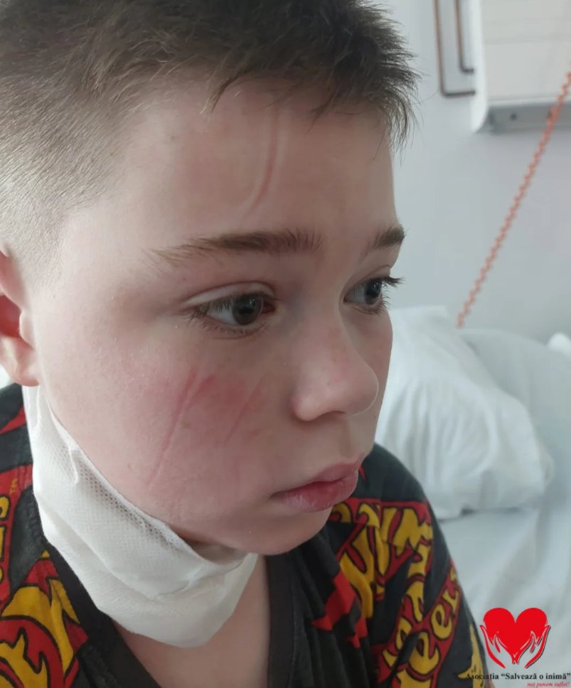 Un copil de 11 ani se luptă cu un cancer agresiv. "Eric m-a privit și m-a întrebat: «Tati, o să fie bine?» I-am spus că da. Pentru că un tată nu are voie să spună altceva"